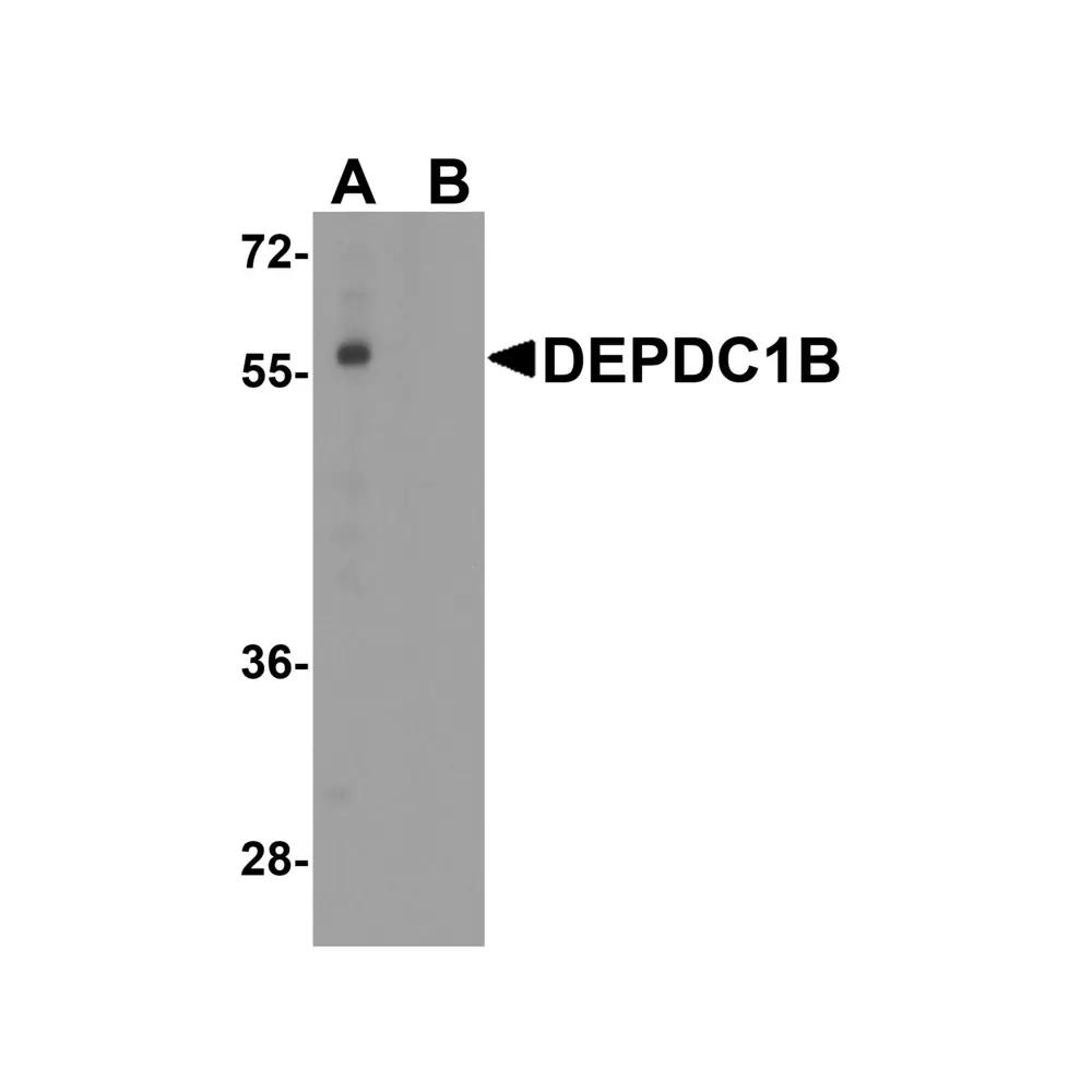 ProSci 8283 DEPDC1B Antibody, ProSci, 0.1 mg/Unit Primary Image