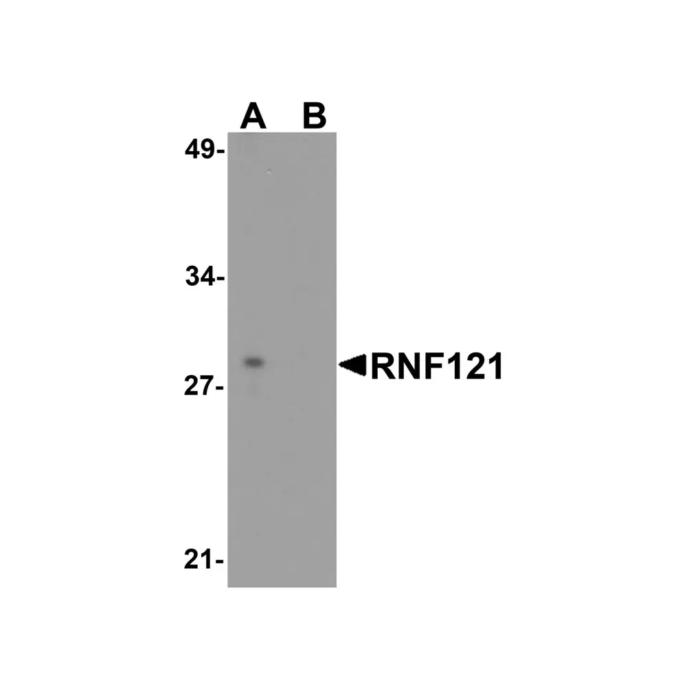 ProSci 8285_S RNF121 Antibody, ProSci, 0.02 mg/Unit Primary Image