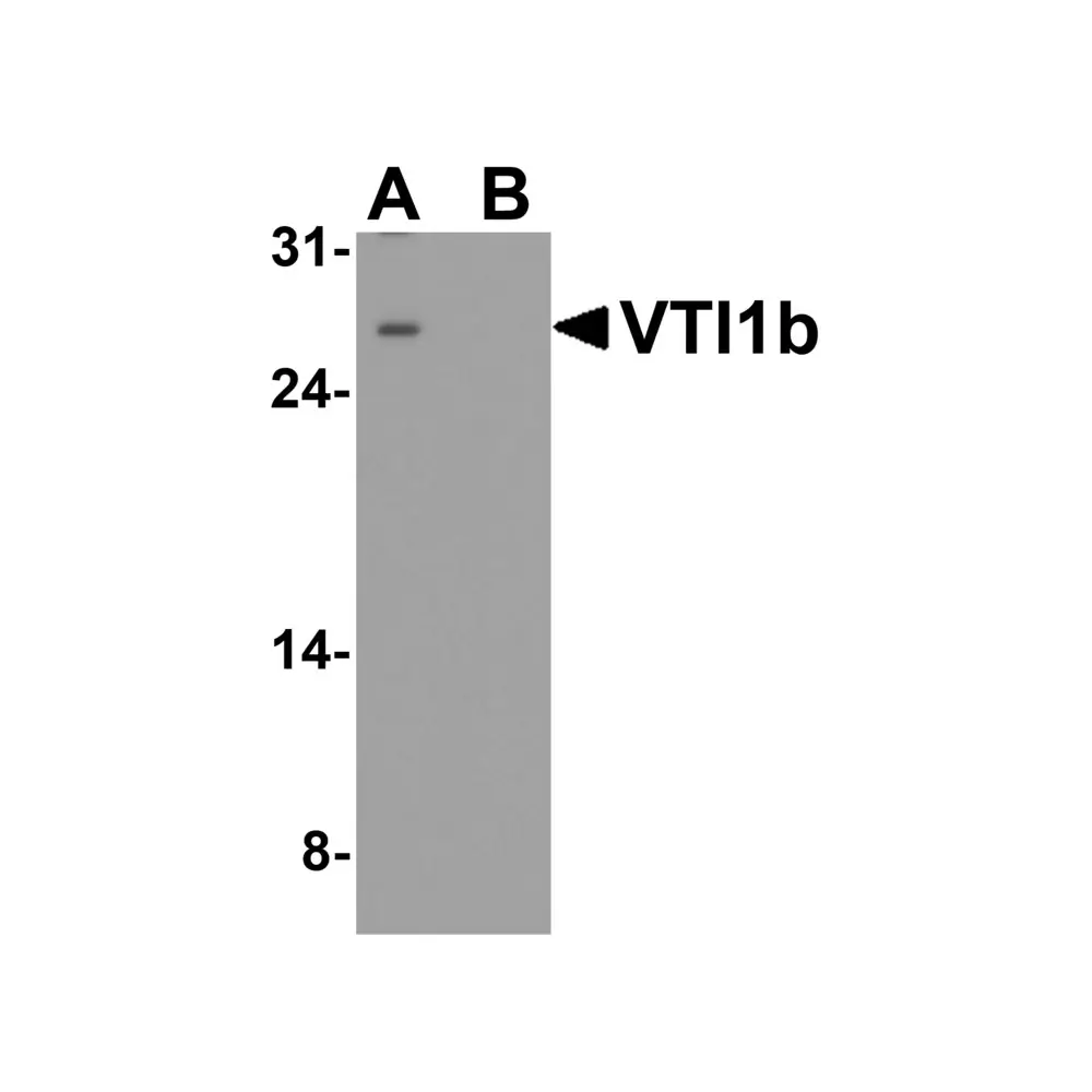 ProSci 8289 VTI1b Antibody, ProSci, 0.1 mg/Unit Primary Image