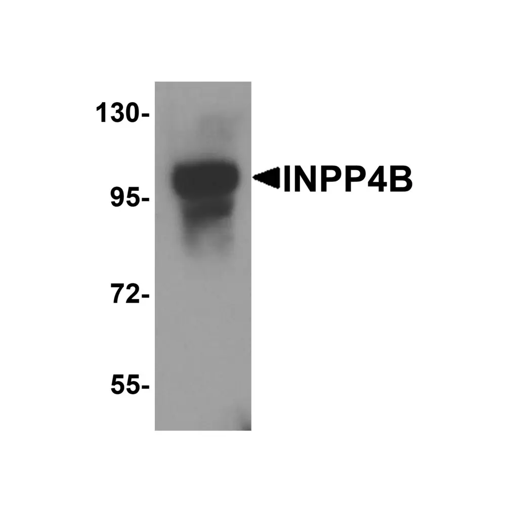 ProSci 8339_S INPP4B Antibody, ProSci, 0.02 mg/Unit Primary Image