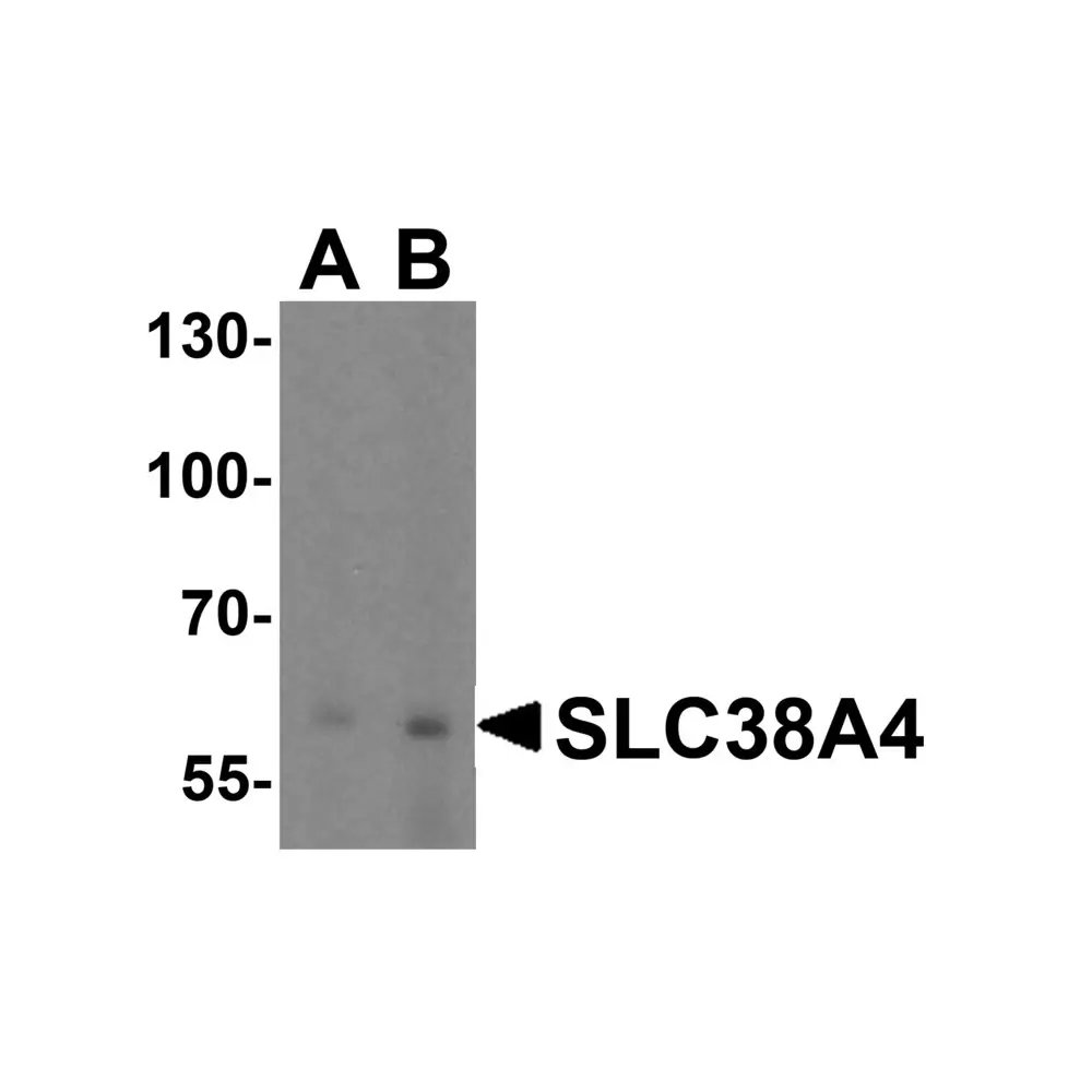 ProSci 8343 SLC38A4 Antibody, ProSci, 0.1 mg/Unit Primary Image