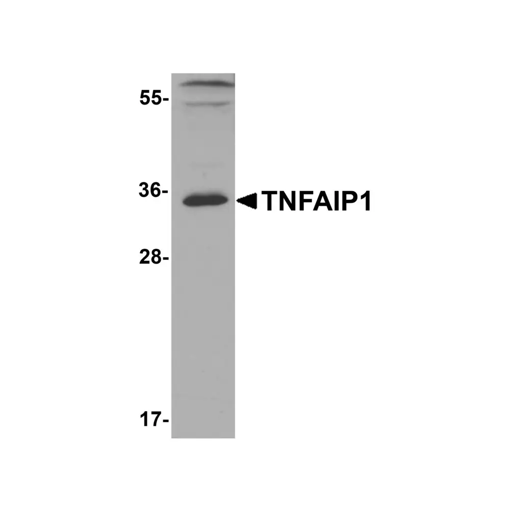 ProSci 8345 TNFAIP1 Antibody, ProSci, 0.1 mg/Unit Primary Image