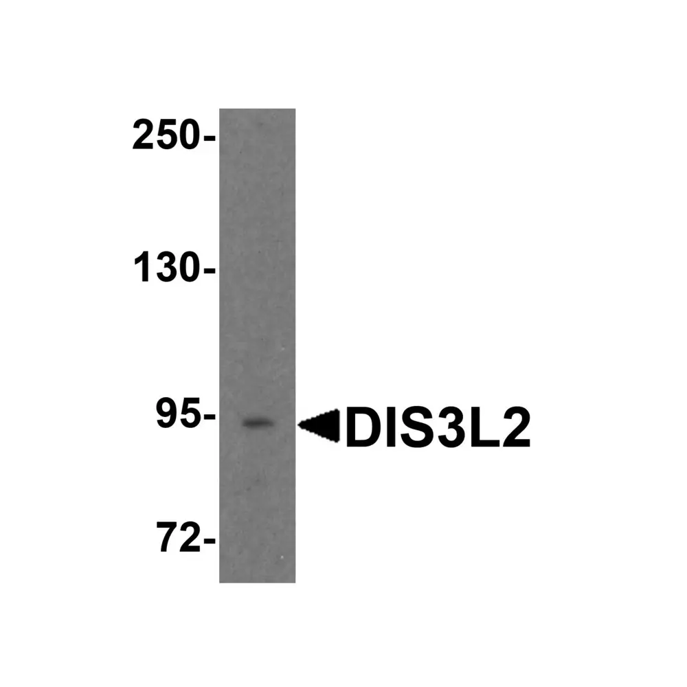 ProSci 8347_S DIS3L2 Antibody, ProSci, 0.02 mg/Unit Primary Image