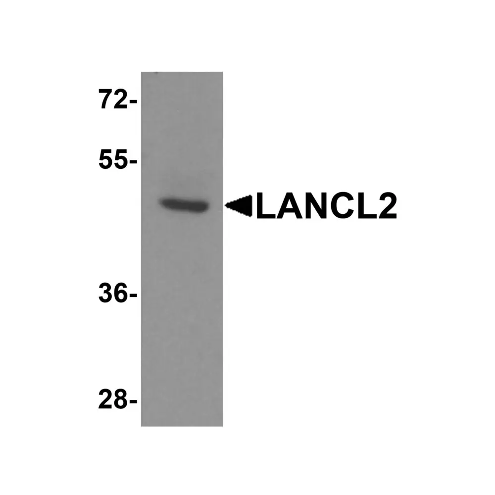 ProSci 8369 LANCL2 Antibody, ProSci, 0.1 mg/Unit Primary Image