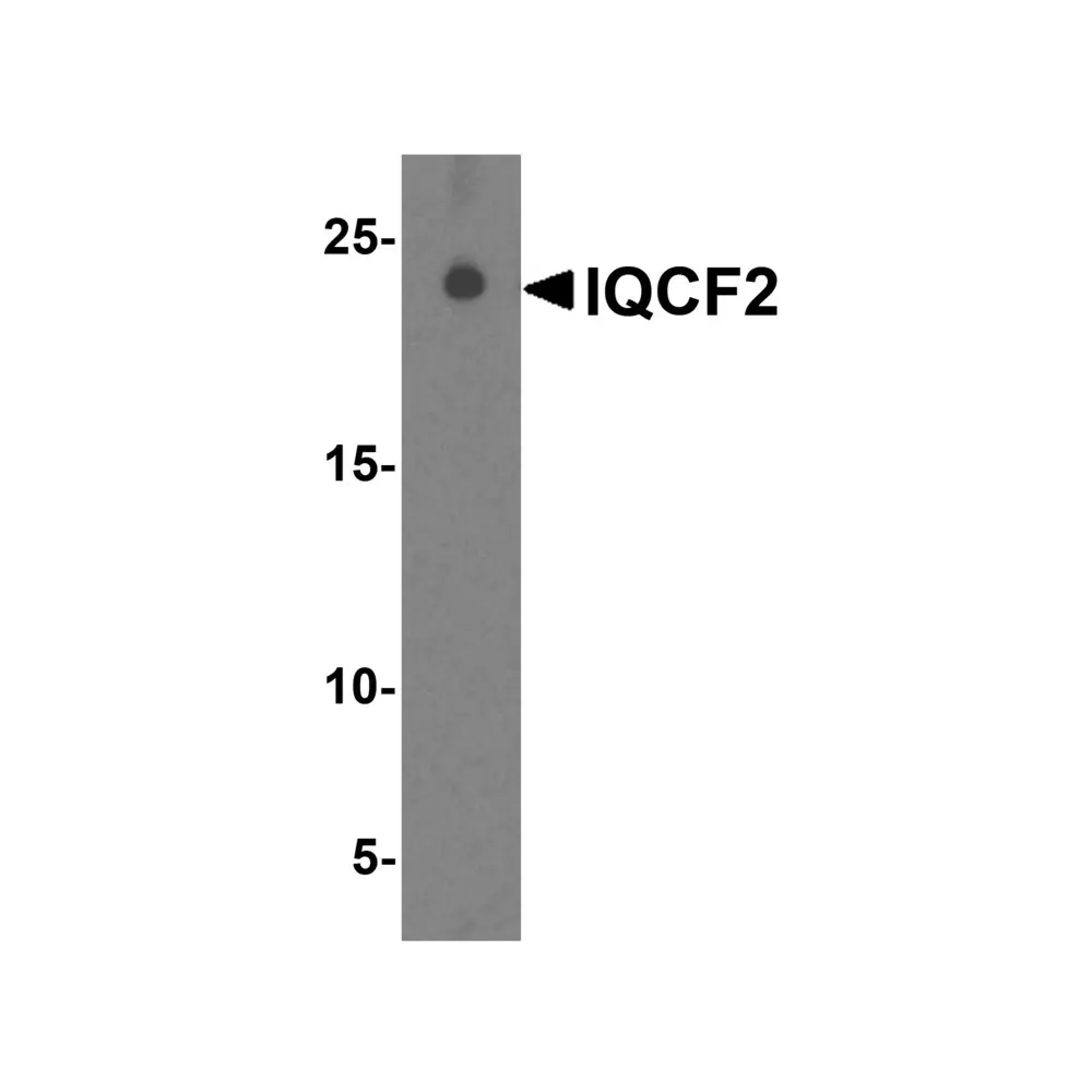 ProSci 8419_S IQCF2 Antibody, ProSci, 0.02 mg/Unit Primary Image