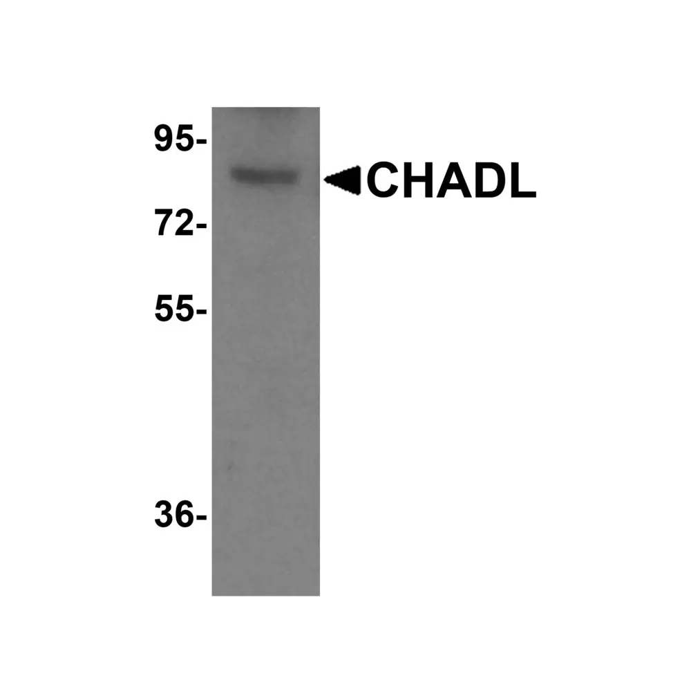 ProSci 8423 CHADL Antibody, ProSci, 0.1 mg/Unit Primary Image