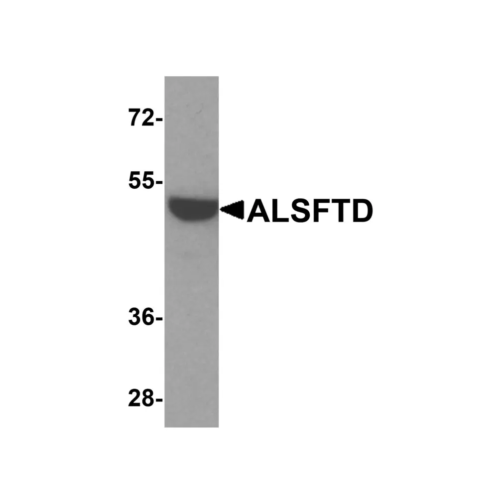 ProSci 8469_S ALSFTD Antibody, ProSci, 0.02 mg/Unit Primary Image