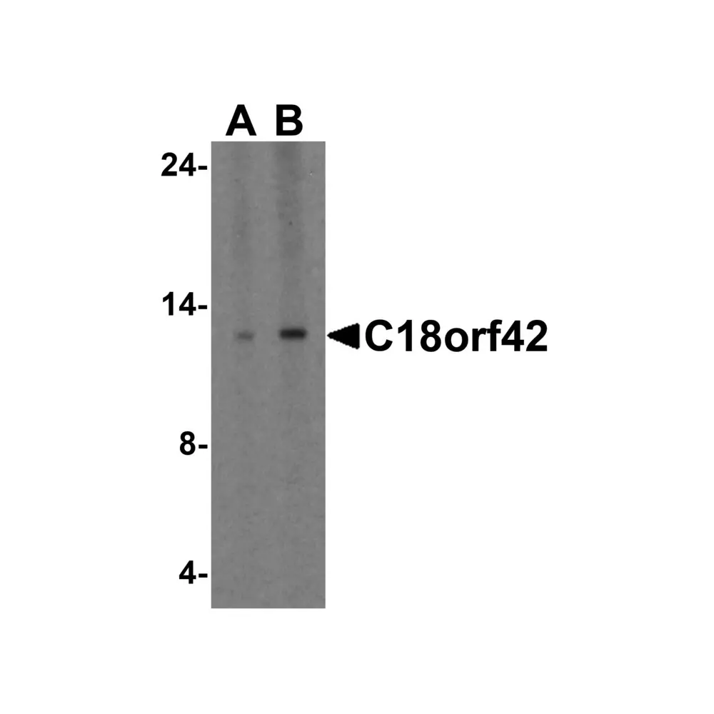 ProSci 8471_S C18orf42 Antibody, ProSci, 0.02 mg/Unit Primary Image