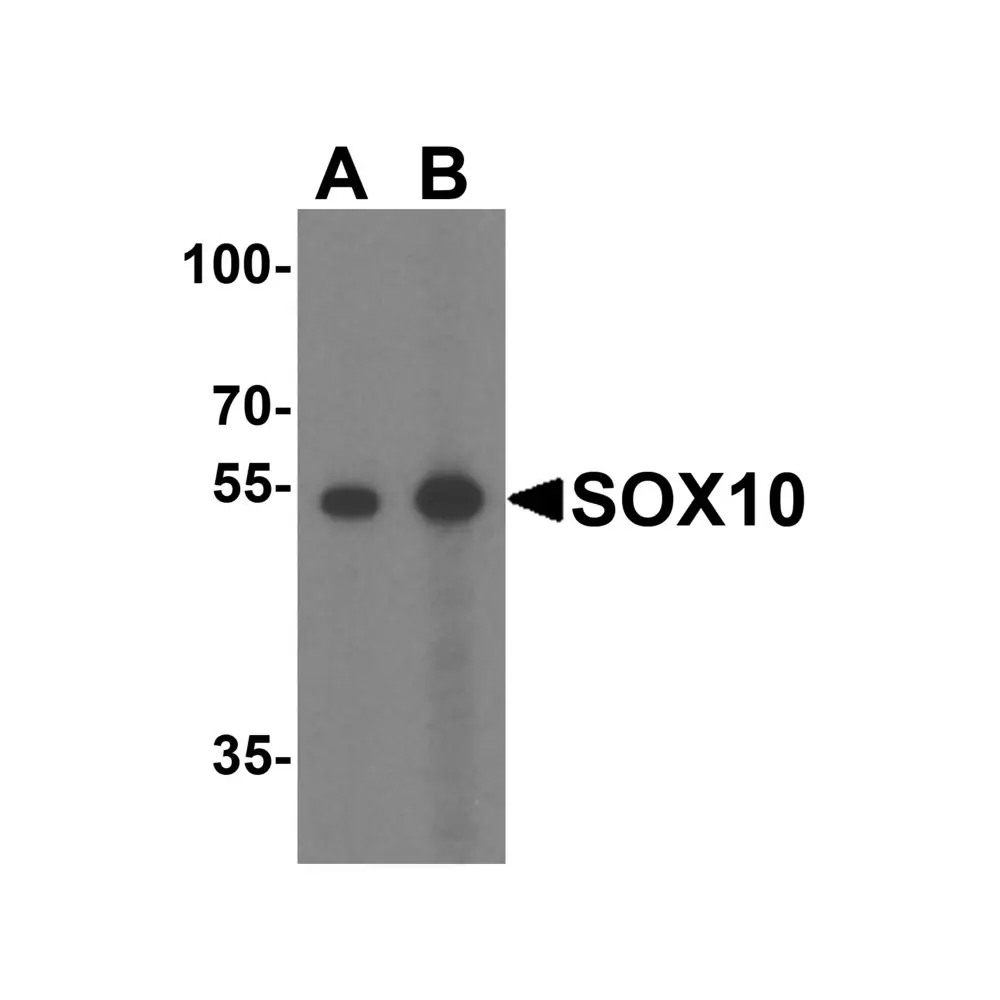ProSci 8481 SOX10 Antibody, ProSci, 0.1 mg/Unit Primary Image