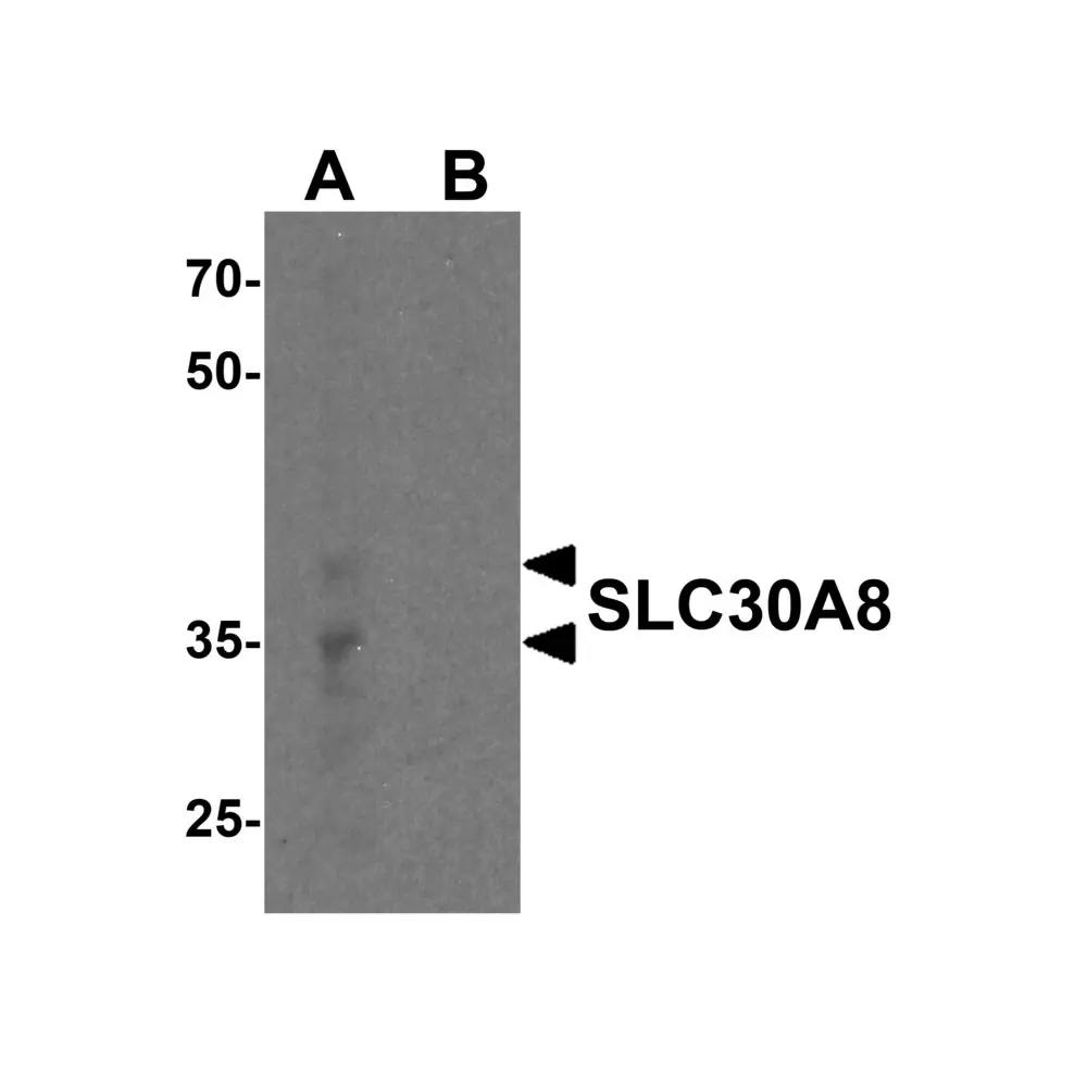 ProSci 8485 SLC30A8 Antibody, ProSci, 0.1 mg/Unit Primary Image