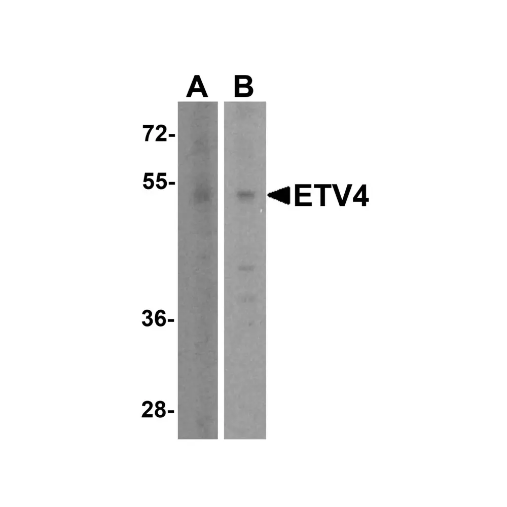 ProSci 8535 ETV4 Antibody, ProSci, 0.1 mg/Unit Primary Image