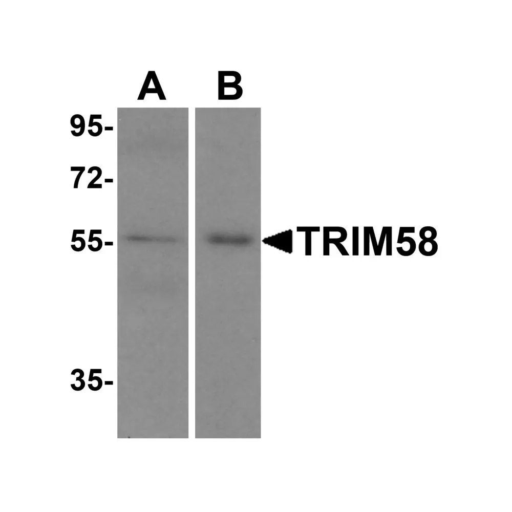 ProSci 8545 TRIM58 Antibody, ProSci, 0.1 mg/Unit Primary Image