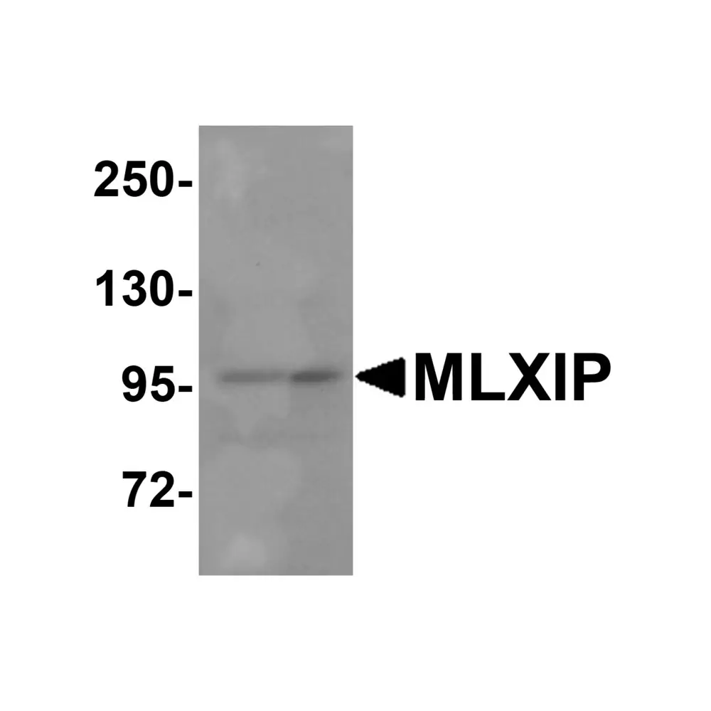 ProSci 8547_S MLXIP Antibody, ProSci, 0.02 mg/Unit Primary Image