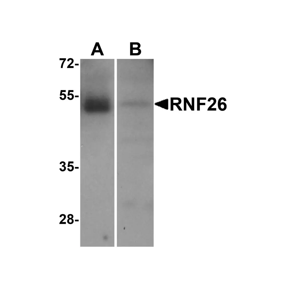 ProSci 8549 RNF26 Antibody, ProSci, 0.1 mg/Unit Primary Image