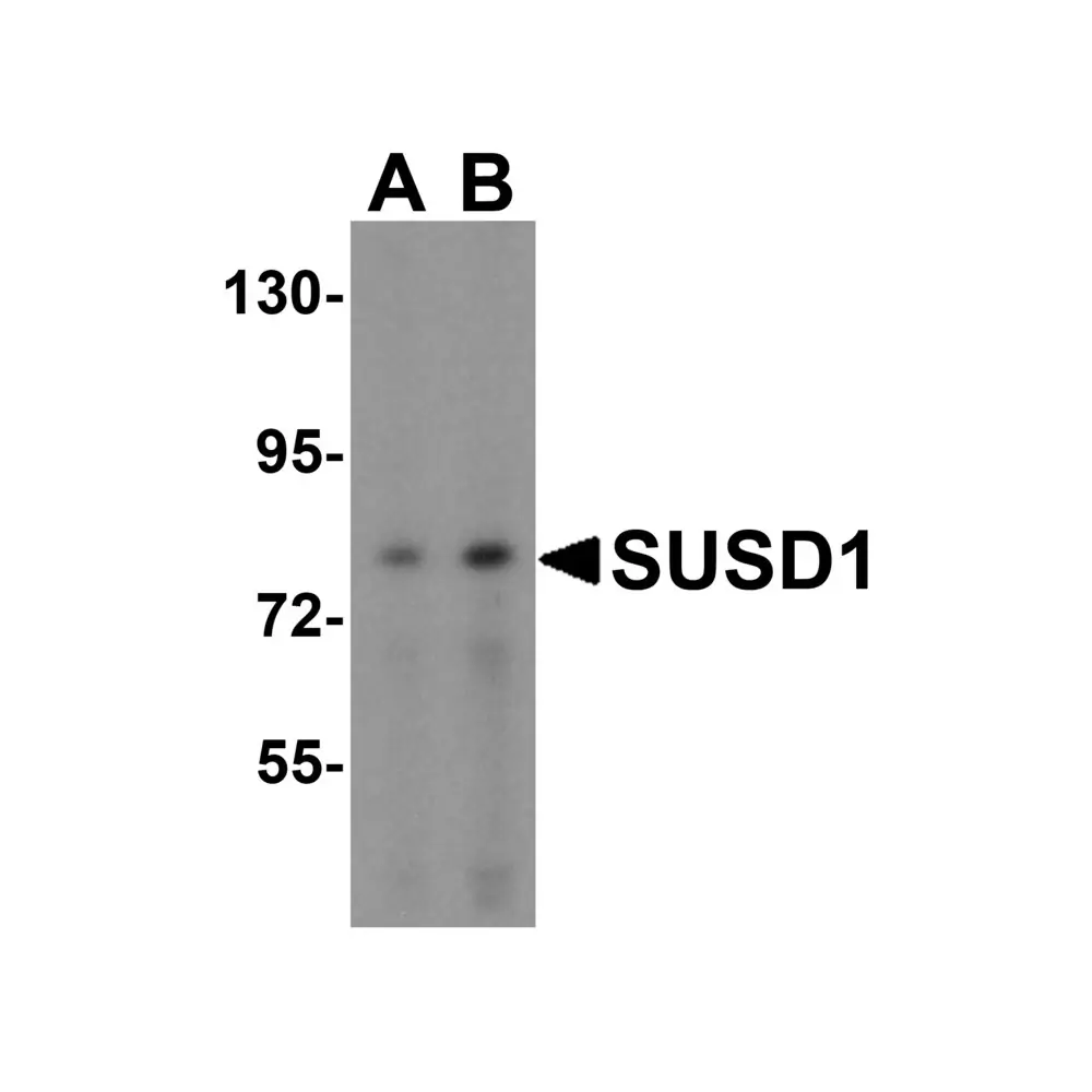 ProSci 8609_S SUSD1 Antibody, ProSci, 0.02 mg/Unit Primary Image