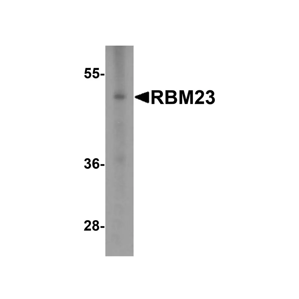 ProSci 8611 RBM23 Antibody, ProSci, 0.1 mg/Unit Primary Image