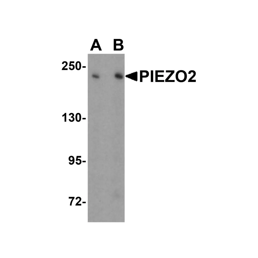 ProSci 8613 PIEZO2 Antibody, ProSci, 0.1 mg/Unit Primary Image