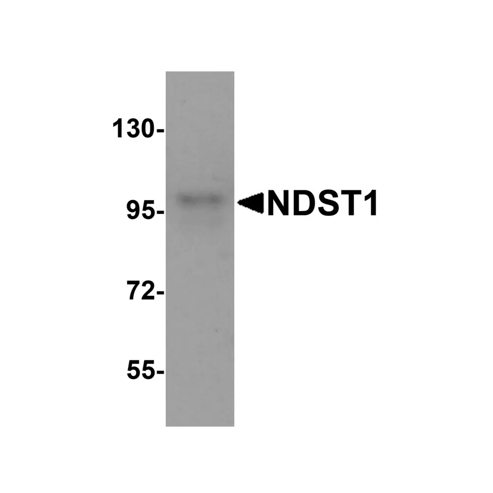 ProSci 8615 NDST1 Antibody, ProSci, 0.1 mg/Unit Primary Image