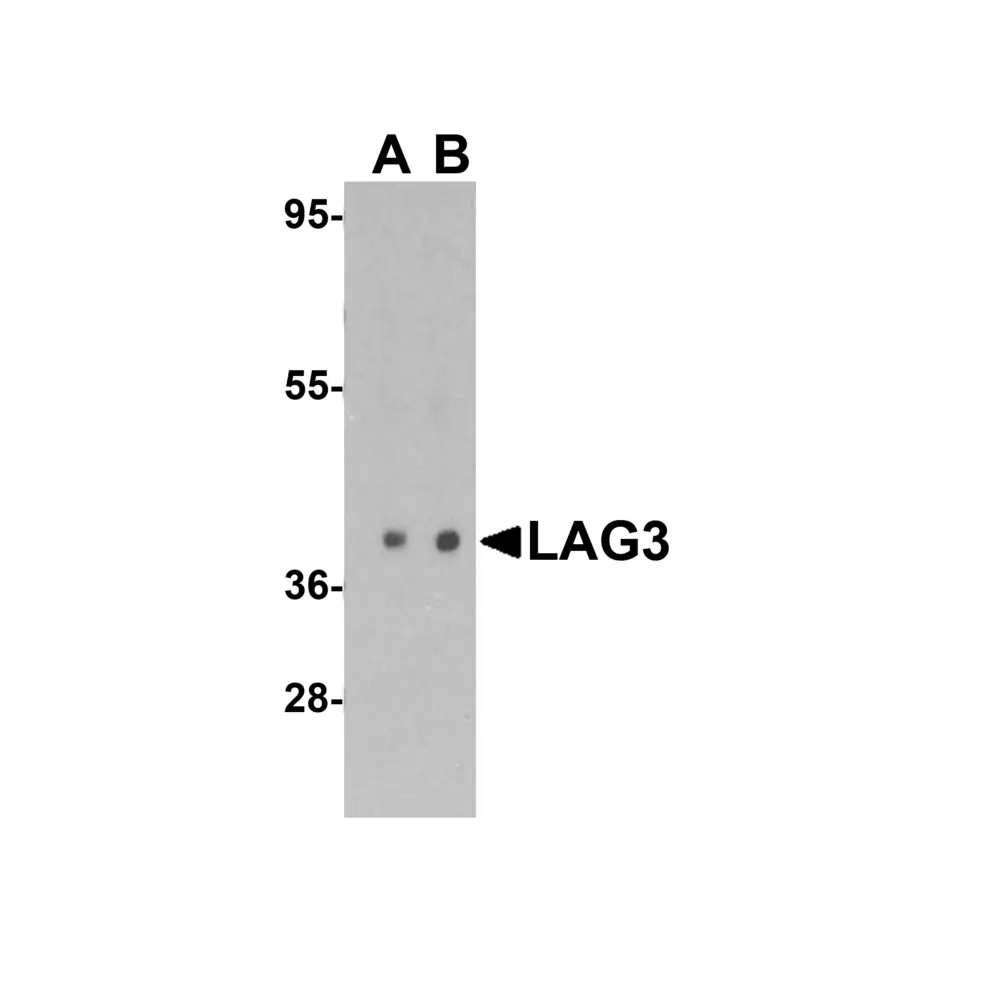 ProSci 8657 LAG3 Antibody, ProSci, 0.1 mg/Unit Primary Image