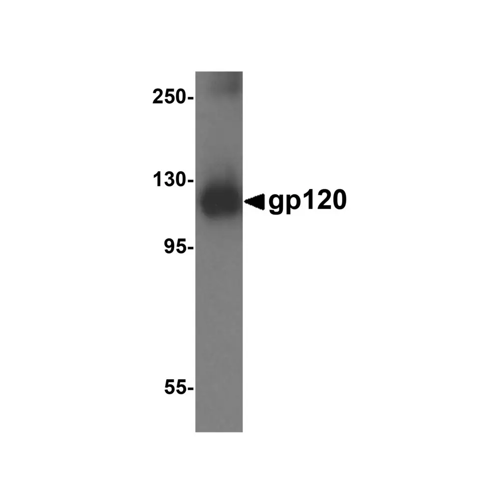 ProSci 8677 gp120 Antibody, ProSci, 0.1 mg/Unit Primary Image