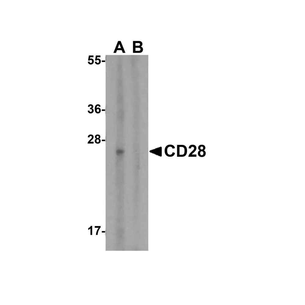 ProSci 8683 CD28 Antibody, ProSci, 0.1 mg/Unit Primary Image