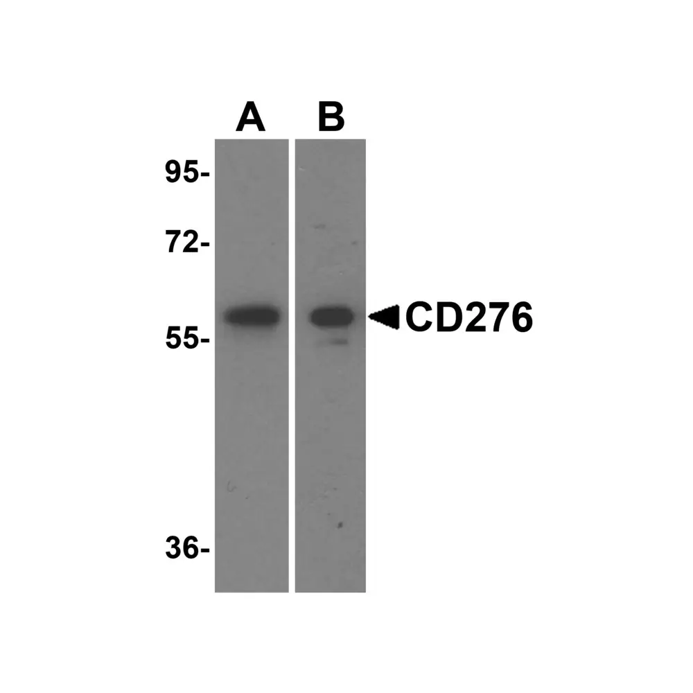 ProSci 8689_S CD276 Antibody, ProSci, 0.02 mg/Unit Primary Image