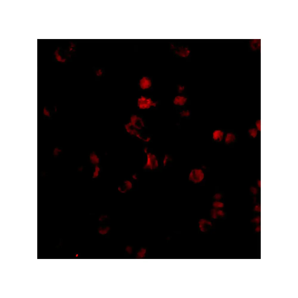ProSci 3039_S AATF Antibody, ProSci, 0.02 mg/Unit Tertiary Image