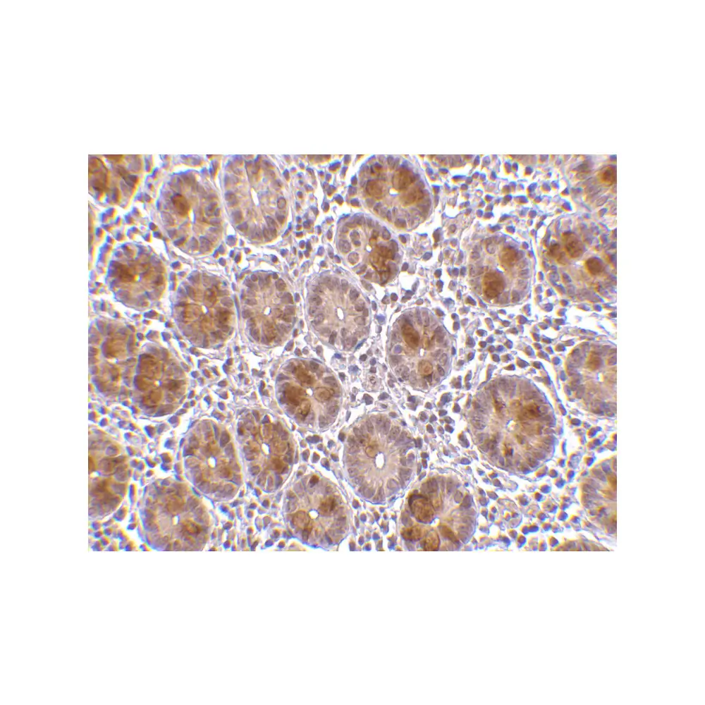 ProSci 3039 AATF Antibody, ProSci, 0.1 mg/Unit Secondary Image