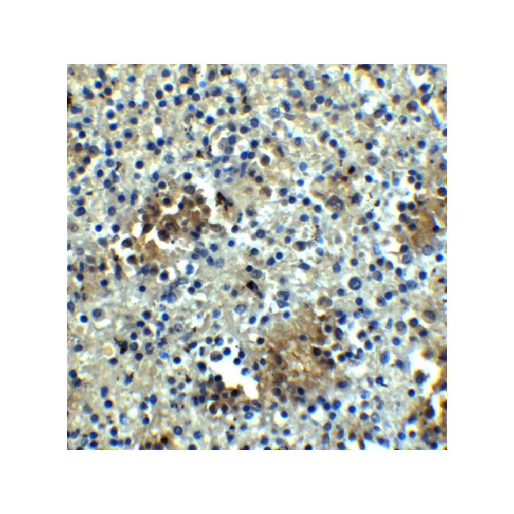 ProSci 6889 ABCA7 Antibody, ProSci, 0.1 mg/Unit Secondary Image