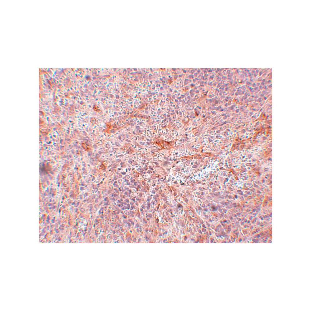 ProSci 5303 ABIN3 Antibody, ProSci, 0.1 mg/Unit Secondary Image