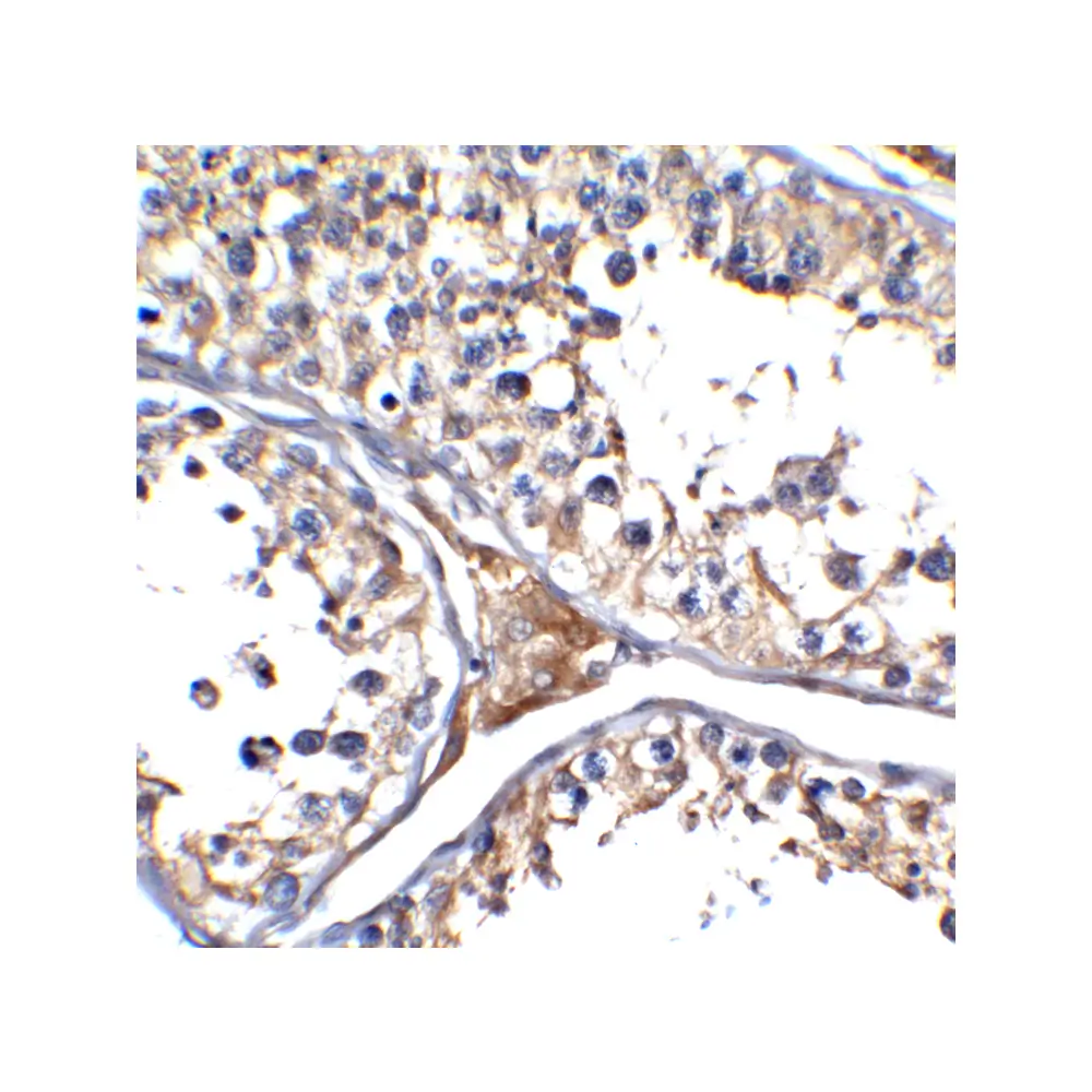ProSci 3217-HRP ACE2 Antibody (HRP), ProSci, 0.1 mg/Unit Secondary Image