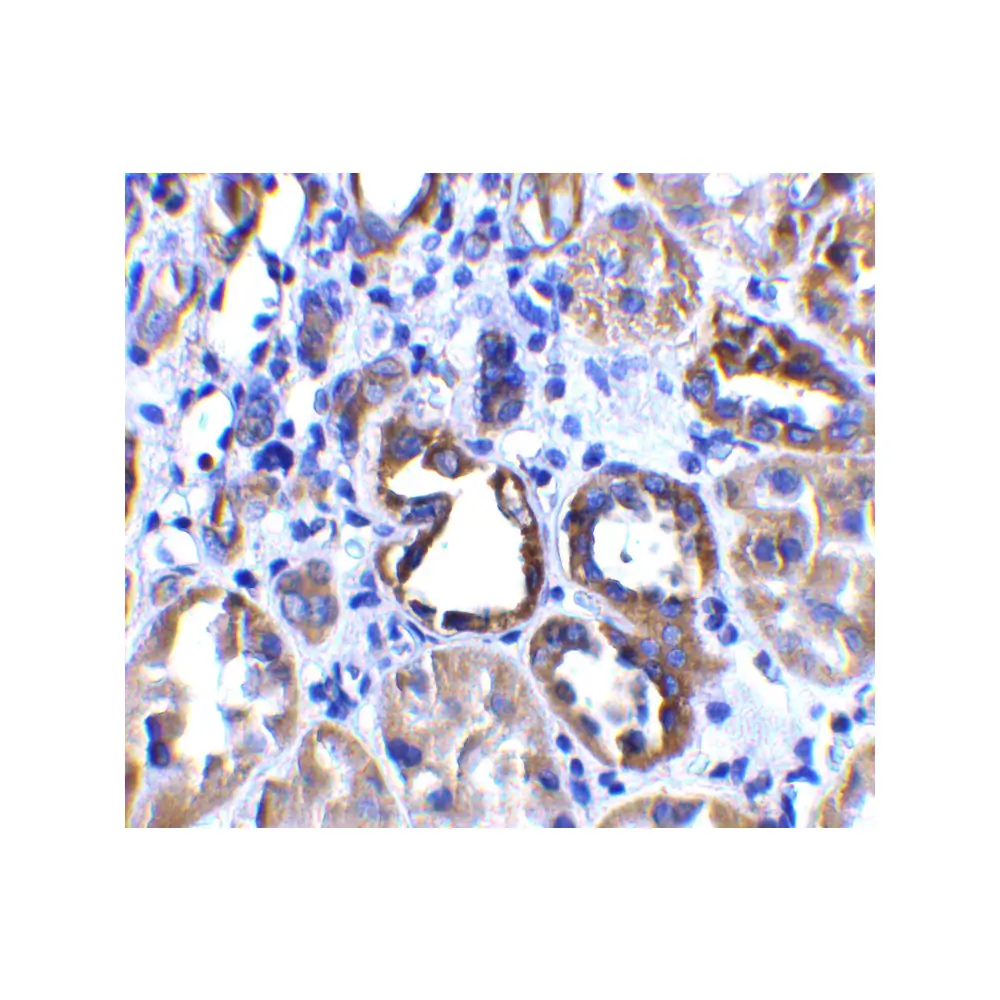 ProSci 3229 ACE2 Antibody, ProSci, 0.1 mg/Unit Quaternary Image