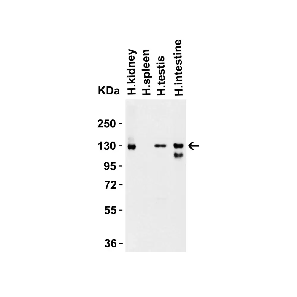ProSci 3215 ACE2 Antibody, ProSci, 0.1 mg/Unit Secondary Image