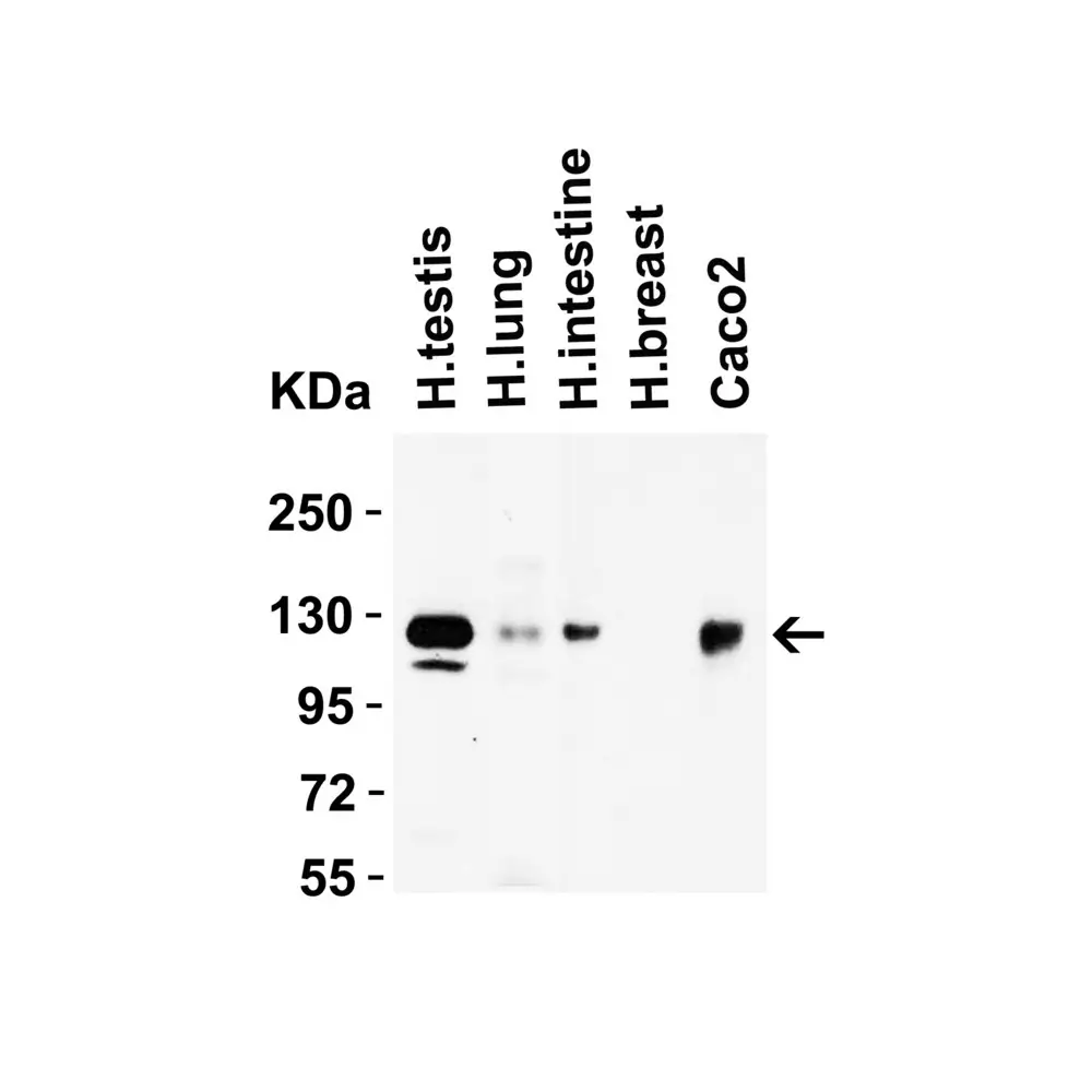 ProSci 3217 ACE2 Antibody, ProSci, 0.1 mg/Unit Secondary Image