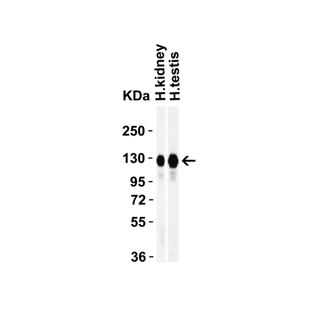 ProSci 3227 ACE2 Antibody, ProSci, 0.1 mg/Unit Secondary Image