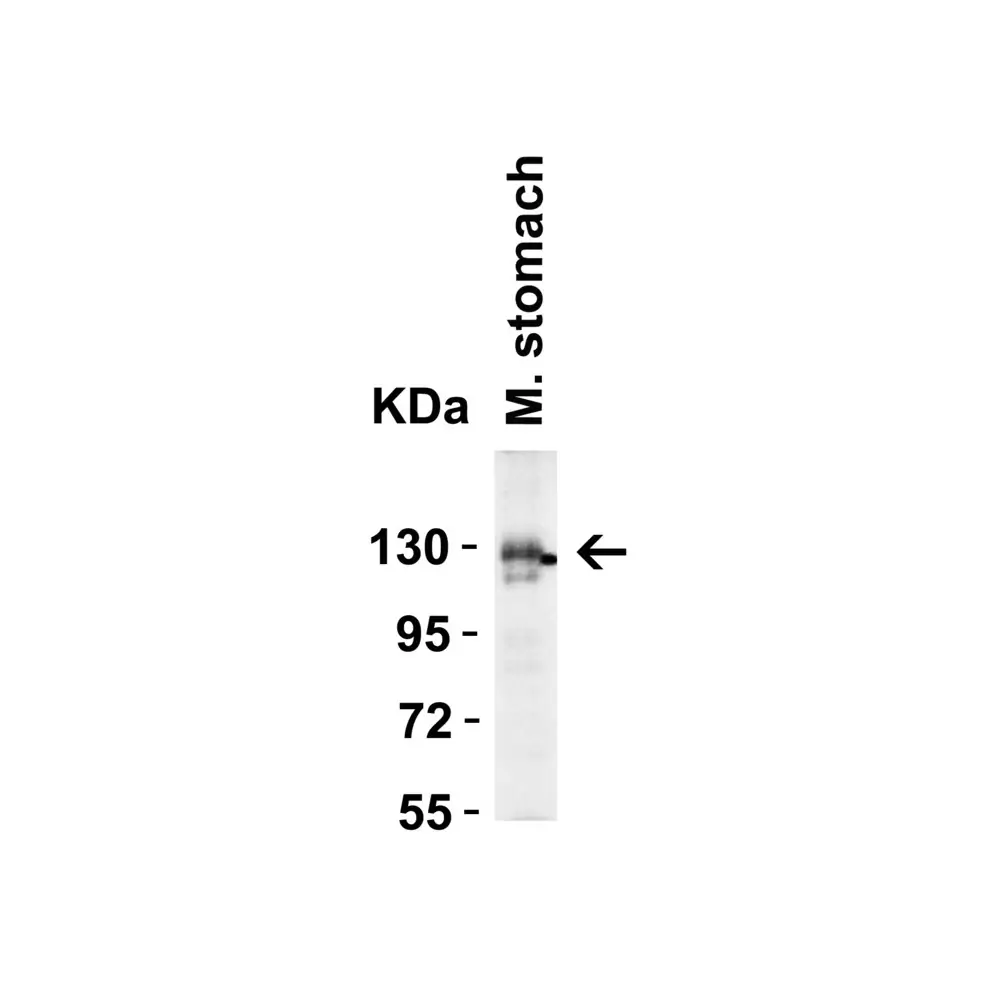 ProSci 3229 ACE2 Antibody, ProSci, 0.1 mg/Unit Secondary Image