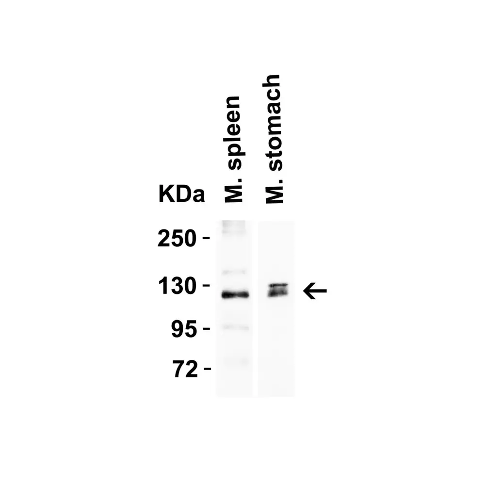 ProSci 3215 ACE2 Antibody, ProSci, 0.1 mg/Unit Tertiary Image
