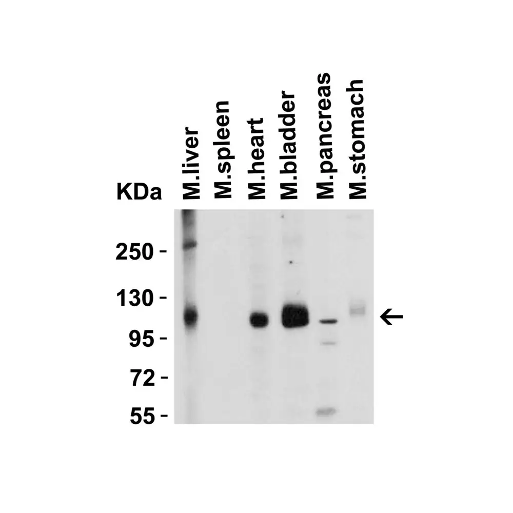 ProSci 3217 ACE2 Antibody, ProSci, 0.1 mg/Unit Tertiary Image