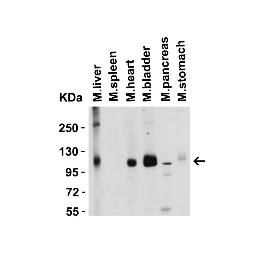 ProSci 3217_S ACE2 Antibody, ProSci, 0.02 mg/Unit Tertiary Image