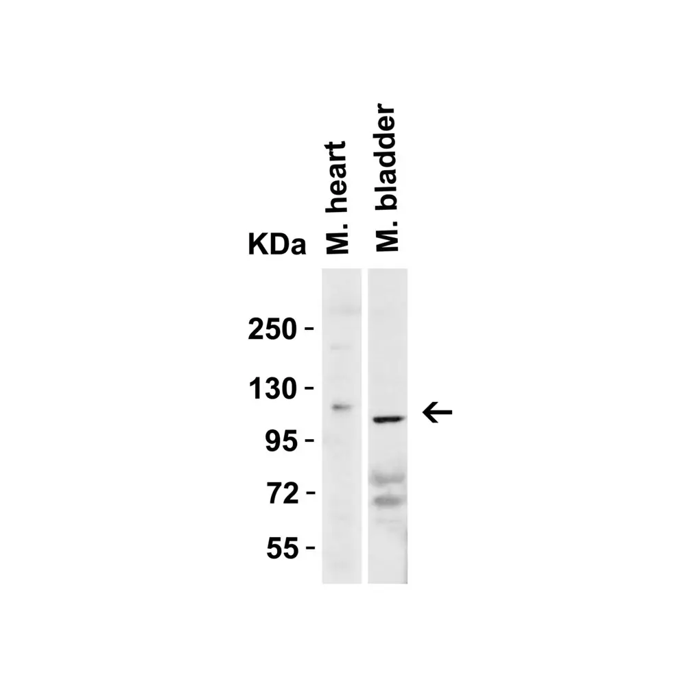 ProSci 3227 ACE2 Antibody, ProSci, 0.1 mg/Unit Tertiary Image