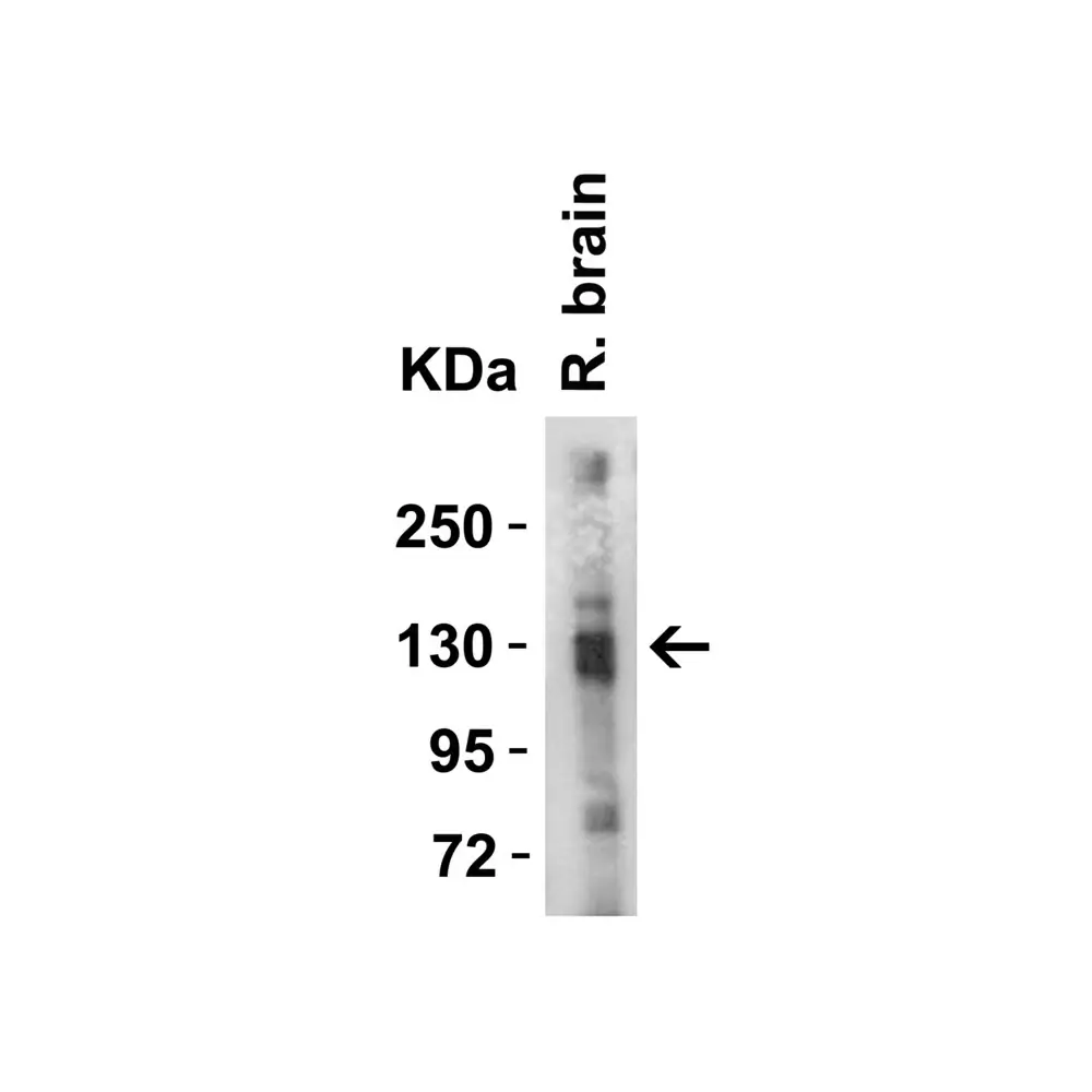 ProSci 3229 ACE2 Antibody, ProSci, 0.1 mg/Unit Tertiary Image