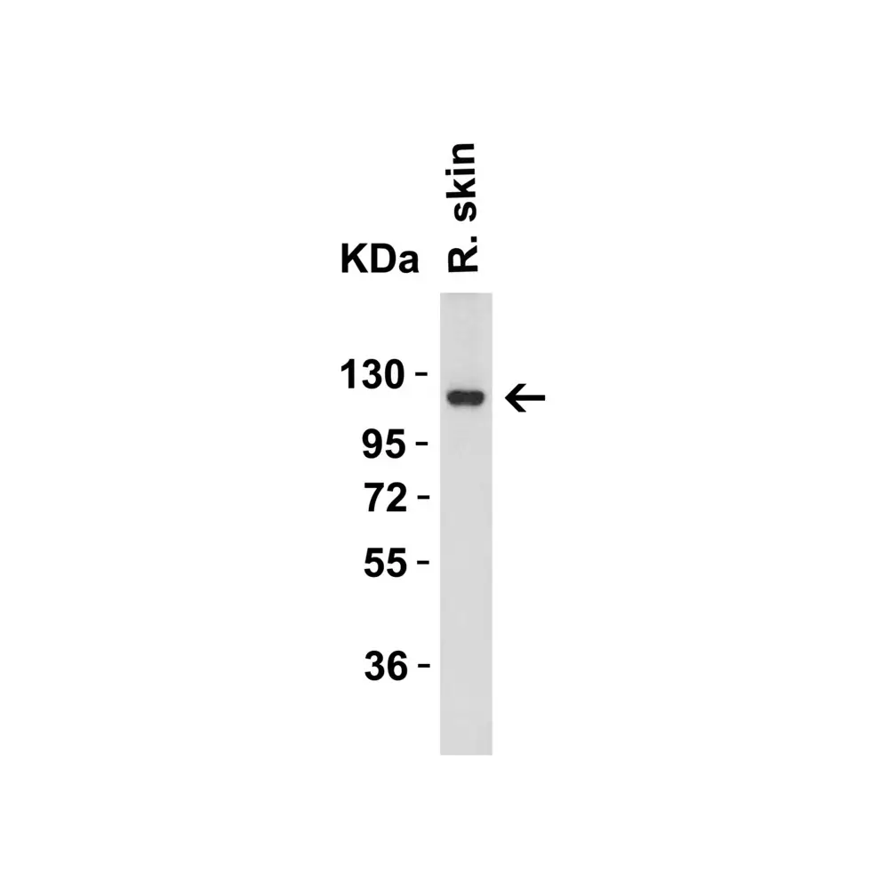 ProSci 3215 ACE2 Antibody, ProSci, 0.1 mg/Unit Quaternary Image