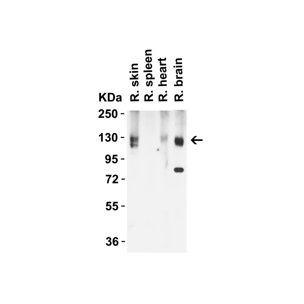 ProSci 3217 ACE2 Antibody, ProSci, 0.1 mg/Unit Quaternary Image