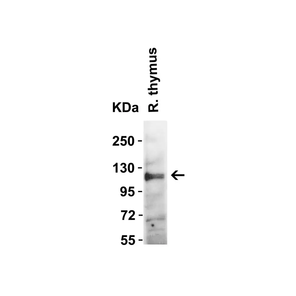 ProSci 3227 ACE2 Antibody, ProSci, 0.1 mg/Unit Quaternary Image