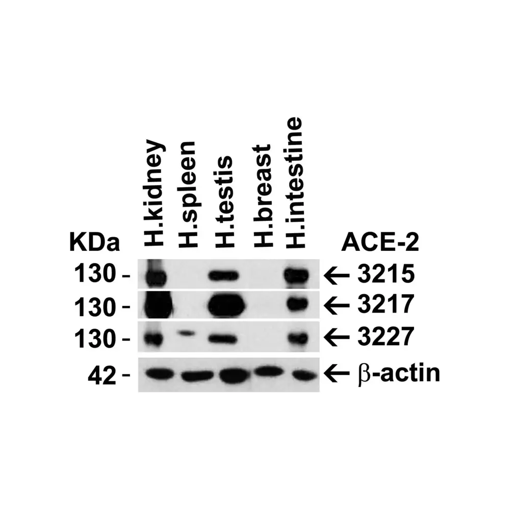 ProSci 3215 ACE2 Antibody, ProSci, 0.1 mg/Unit Primary Image