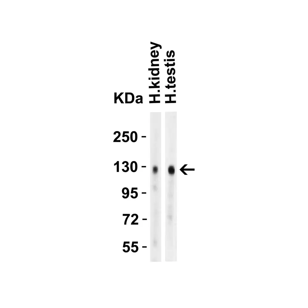 ProSci 3229_S ACE2 Antibody, ProSci, 0.02 mg/Unit Primary Image