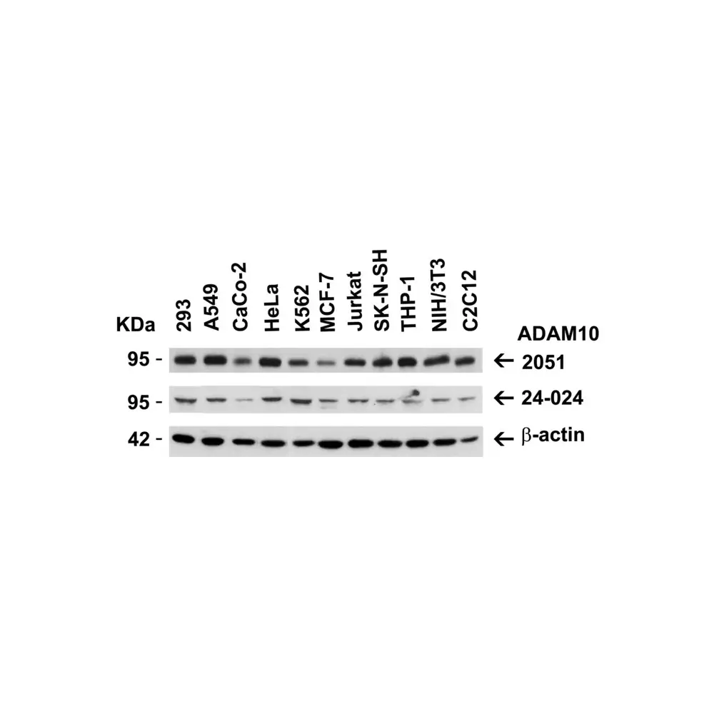 ProSci 2051_S ADAM10 Antibody, ProSci, 0.02 mg/Unit Tertiary Image