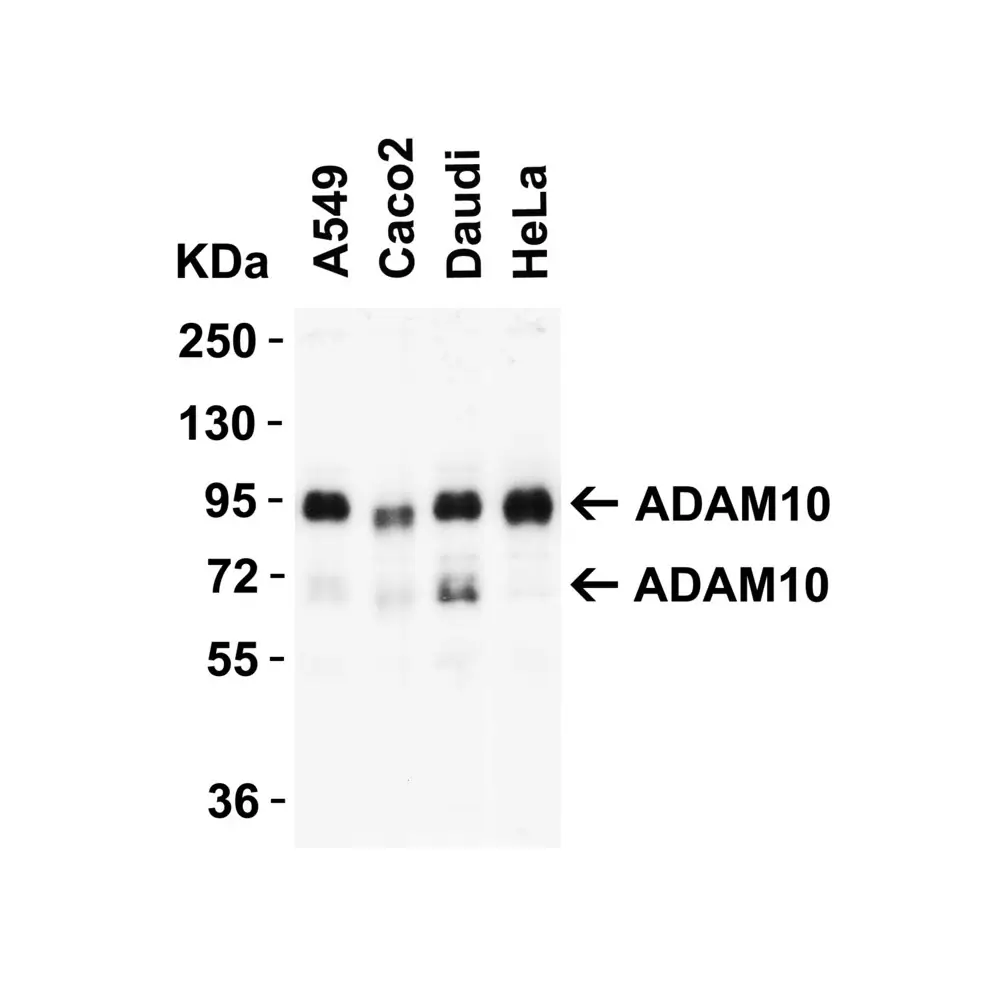 ProSci 2051_S ADAM10 Antibody, ProSci, 0.02 mg/Unit Quaternary Image