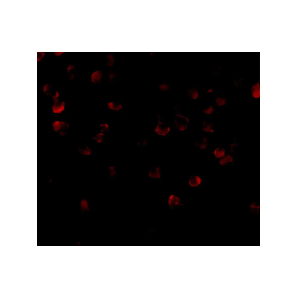 ProSci 4279 ADAP Antibody, ProSci, 0.1 mg/Unit Tertiary Image