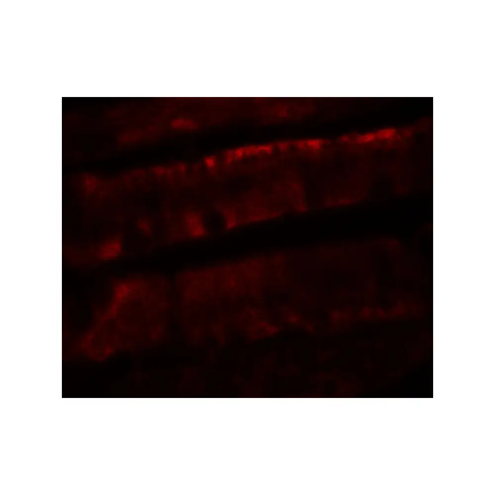 ProSci 8111_S ADORA2B Antibody, ProSci, 0.02 mg/Unit Tertiary Image